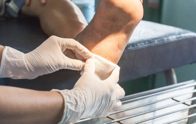Wound Care