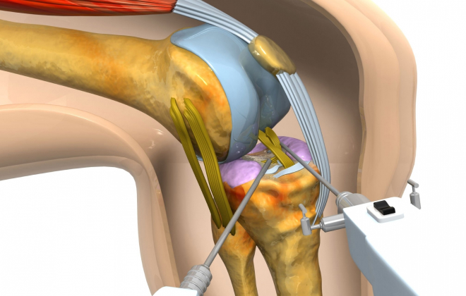 Coe - Orthopaedic