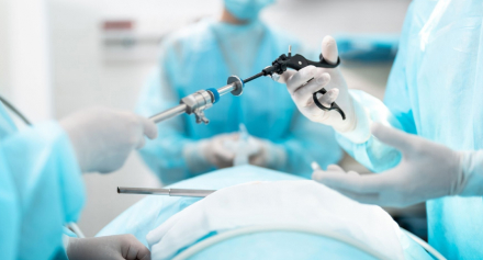 Image representing Laparoscopy – Techniques, Advantages, and Applications