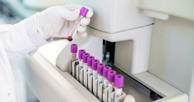 Prostate Health Screenings
