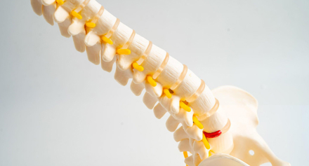 Image representing Understanding Spondylitis: Causes, Symptoms, and Modern Treatment Approaches