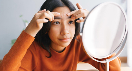 Image representing Managing Acne: From Teen Breakouts to Adult Concerns