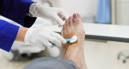Image representing The Overlooked Importance of Small Wounds in Diabetic Wound Care