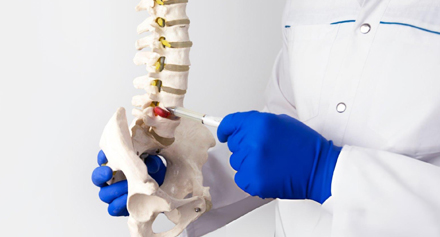 Image representing Slipped Disc Explained: Symptoms, Causes and Recovery Options